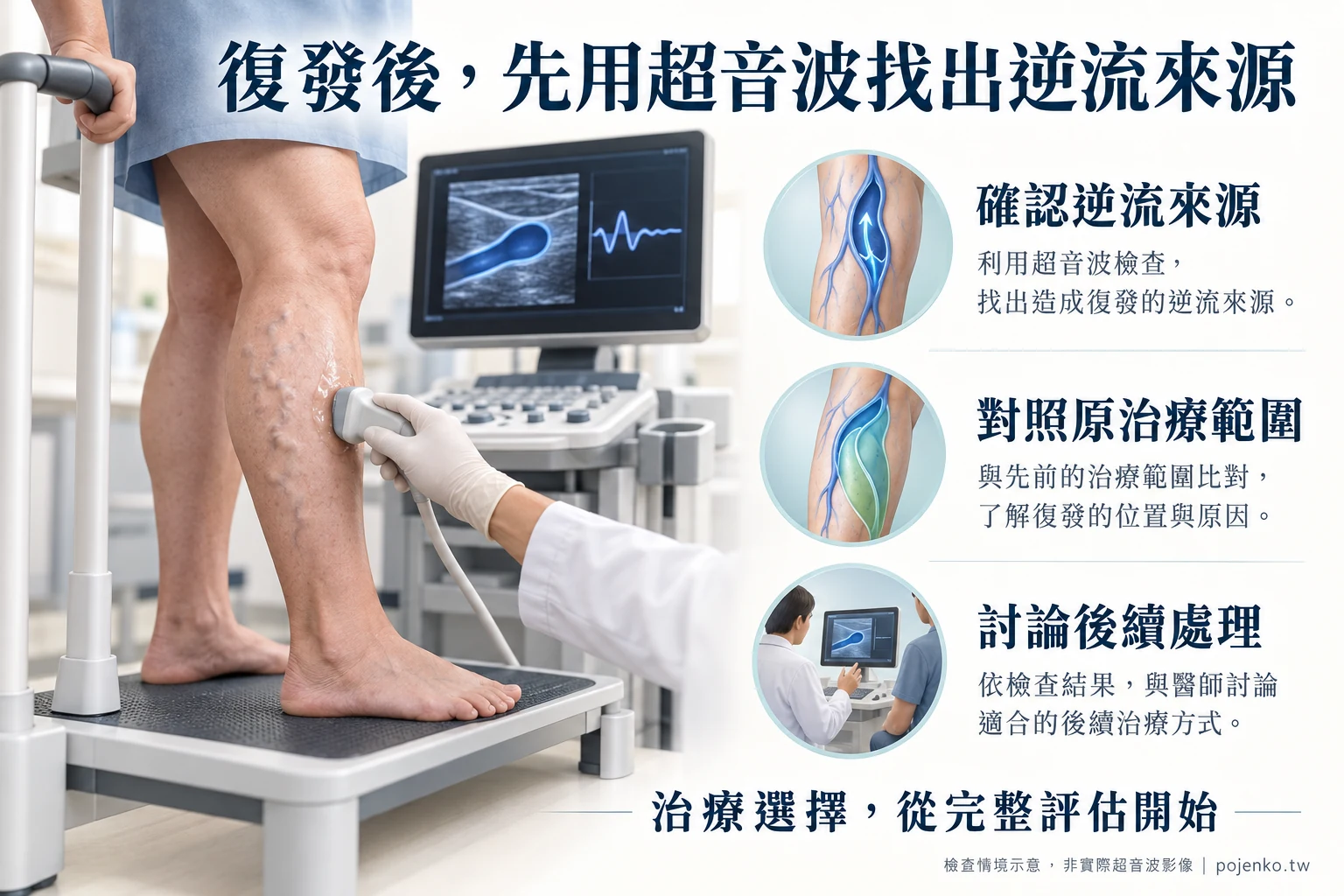 站立姿勢接受下肢靜脈超音波檢查的情境示意,說明確認逆流來源、對照原治療範圍與討論後續處理。